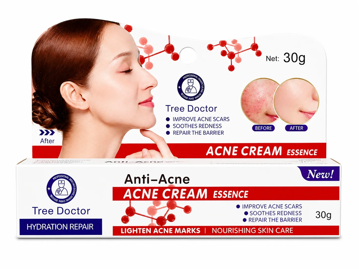 Tree Doctor Anti-Acne Acne Cream Essence – 30g